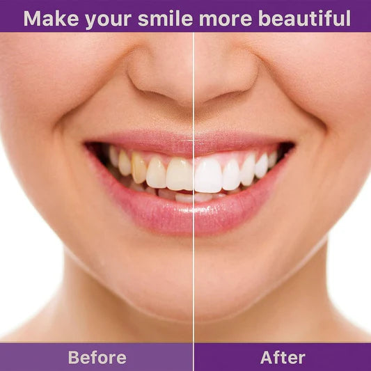 Hismile Toothpaste