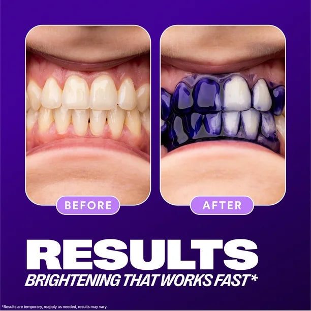 Hismile Toothpaste